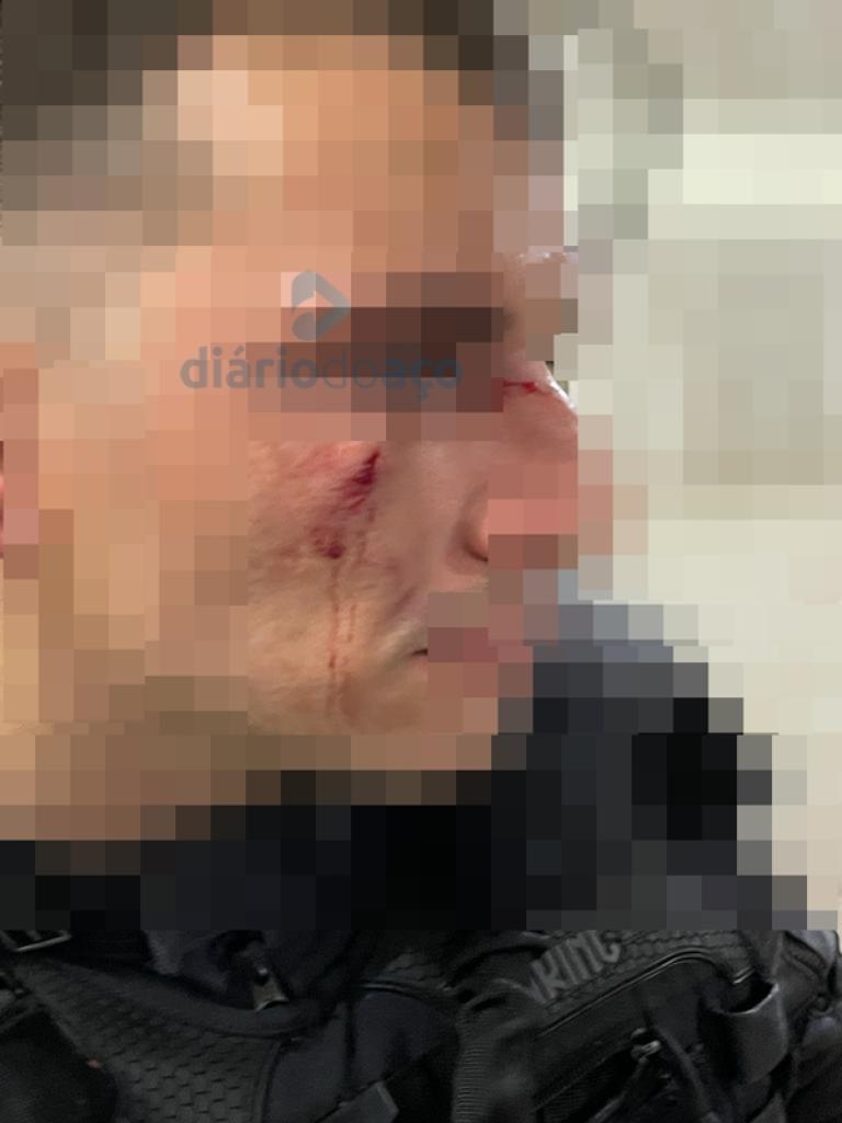 Policial penal sofreu fratura no nariz e ainda um corte no rosto ao ser agredido pelo preso