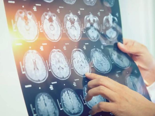  Nos últimos 20 anos, o crescimento dos casos já foi de 100%, evidenciando a necessidade de maior atenção à oncologia