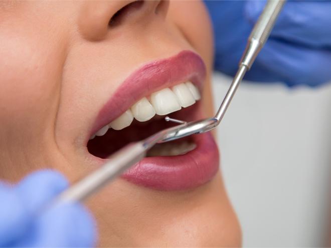 O tratamento durou dois anos e a paciente percebeu que estava pior do que antes, por conta de um trabalho malfeito pelo dentista responsável