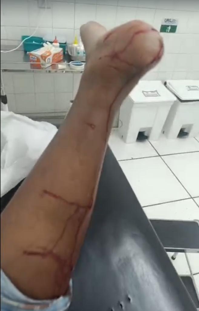 Um idoso também alega ter sido atacado