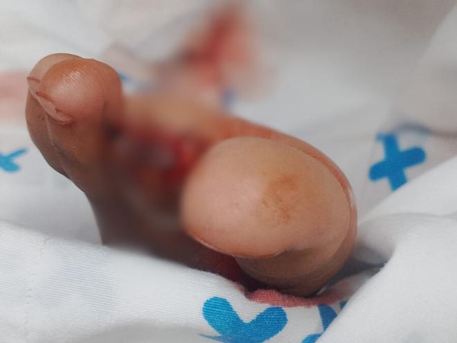 Uma criança de quatro anos foi vítima do ataque e precisou passar por cirurgia 