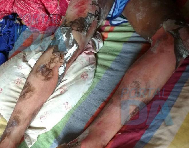 Um dos adolescentes que participou do atentado foi encontrado em casa, com queimaduras generalizadas 
