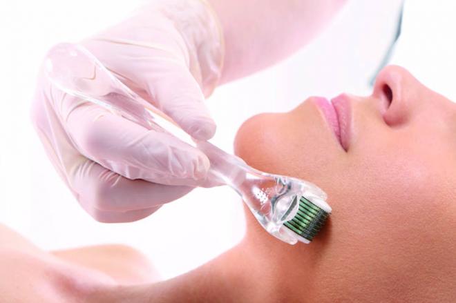 O dermaroller pode ser aplicado em todo o rosto; potencializa a ação dos cosméticos e a formulação de colágeno